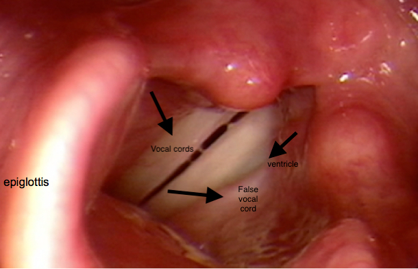 epiglottis and vocal cords